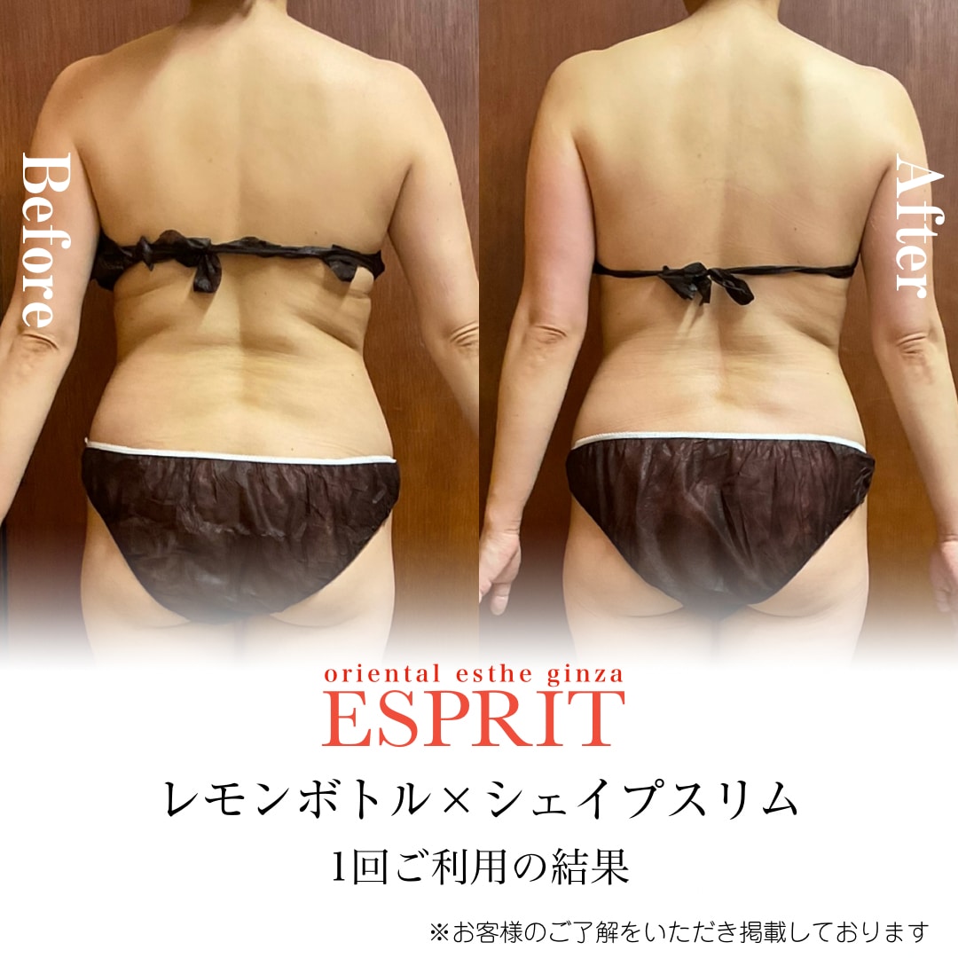 【大幅値下げ】リファインシュール 痩身エステ 大幅値下げ】リファインシュール 痩身エステ 40代から始める本格痩身